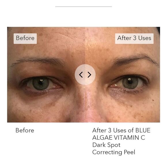 NEW Algenist Blue Algae Vitamin C Dark Spot Correcting Peel - Picture 11 of 12